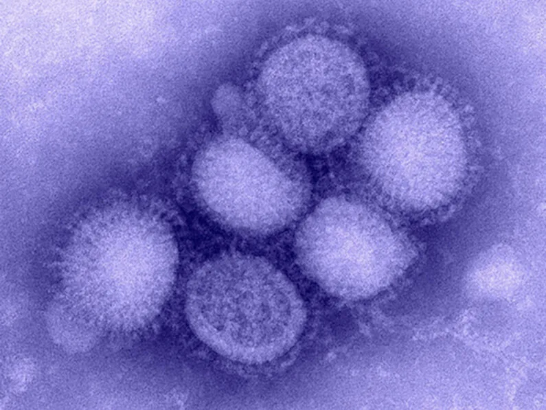 Colorized transmission electron micrograph of clustered, round influenza virus particles with a fuzzy surface texture