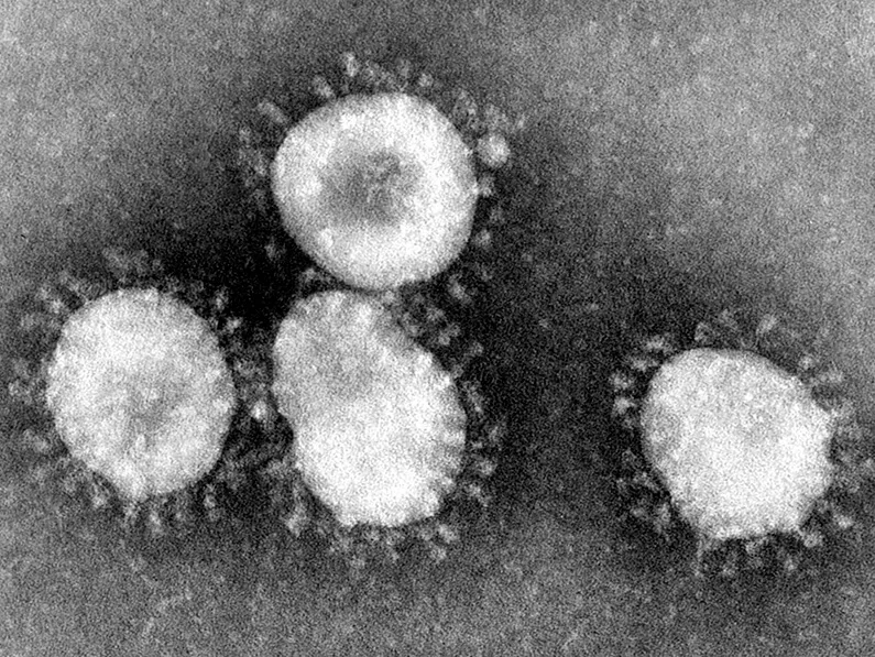 Black and white transmission electron micrograph showing several round coronavirus particles with a fringe of surface spike proteins
