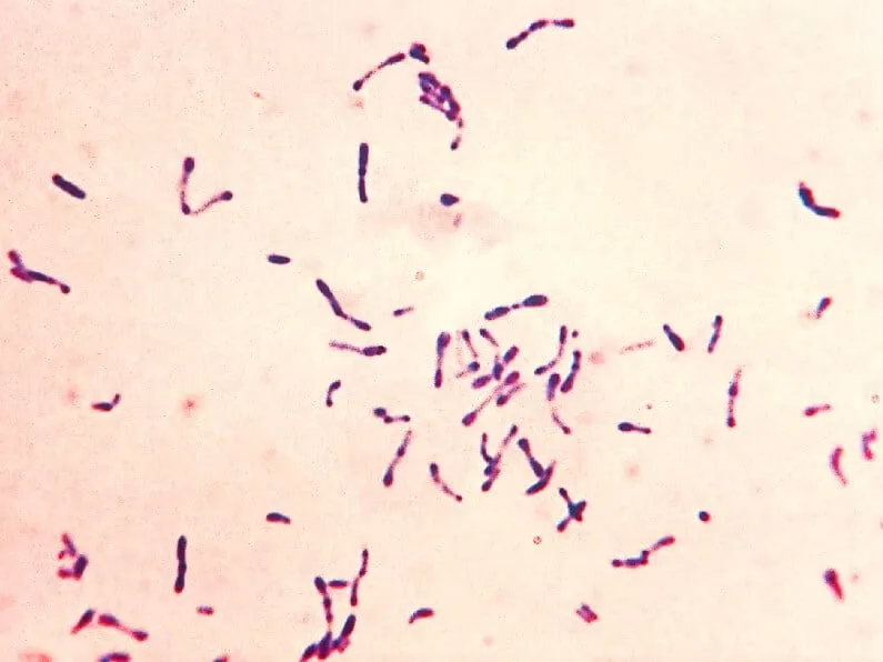 Light micrograph of Corynebacterium diphtheriae, rod-shaped bacteria stained purple-red on a pale pink background