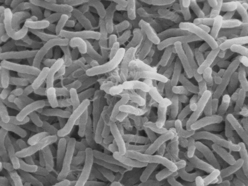 Scanning electron micrograph of densely packed, curved rod-shaped Vibrio cholerae bacteria