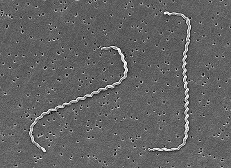 Scanning electron micrograph of two thin, tightly coiled Leptospira bacteria with hooked ends