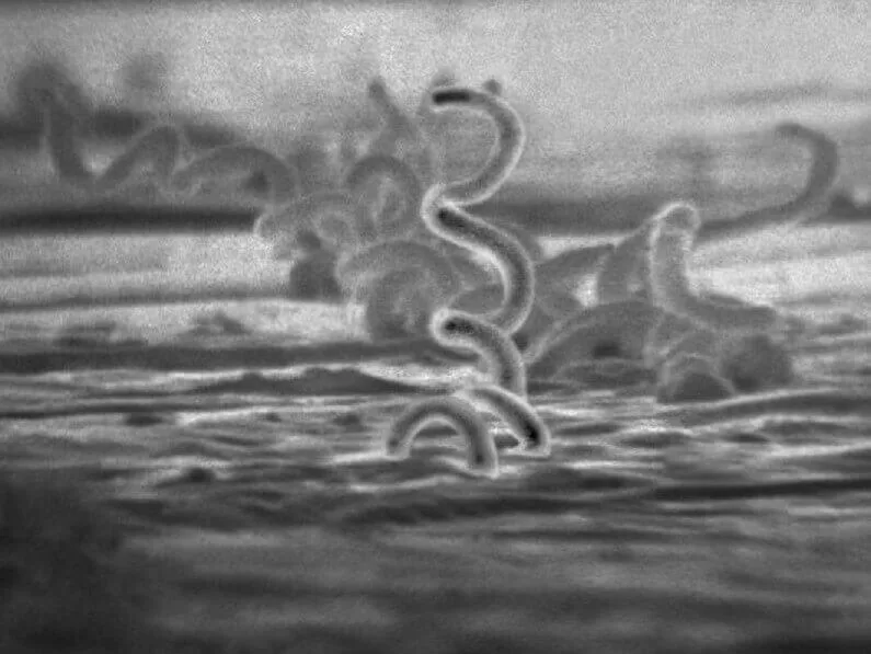 Grayscale micrograph of spiral, corkscrew-shaped Treponema pallidum bacteria