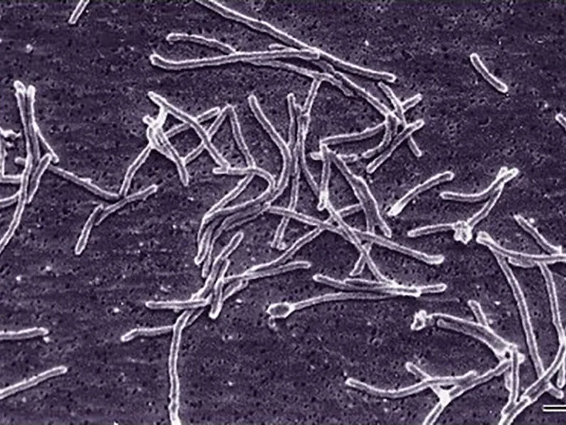Grayscale micrograph of long, thread-like Thermus aquaticus bacteria tangled together