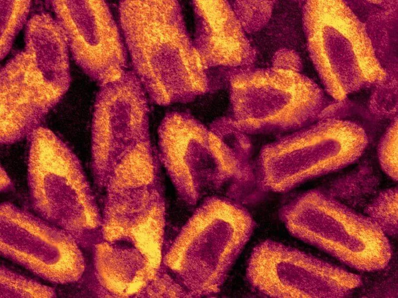 Colorized micrograph of elongated, bullet-shaped rabies virus particles