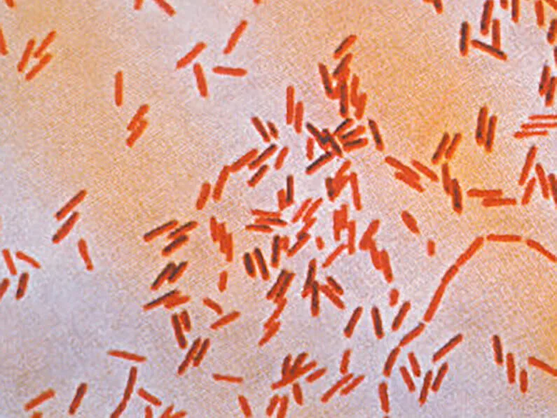 Colorized micrograph of orange, rod-shaped Salmonella enterica Typhi bacteria